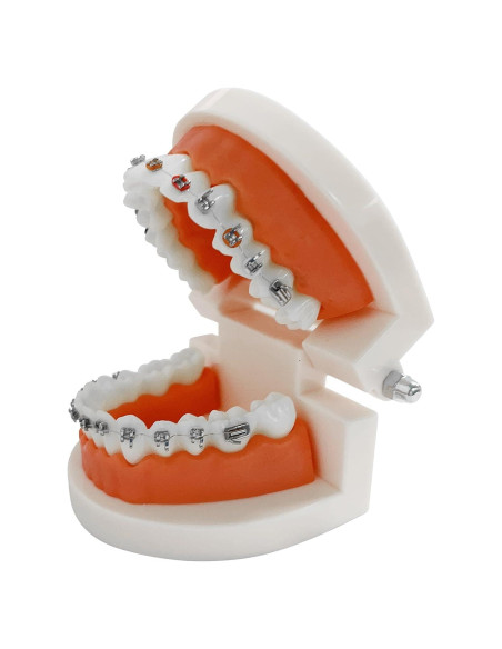 Modelo Dental Ortodontico Ceonam JY+YT con Brackets Coloridos
