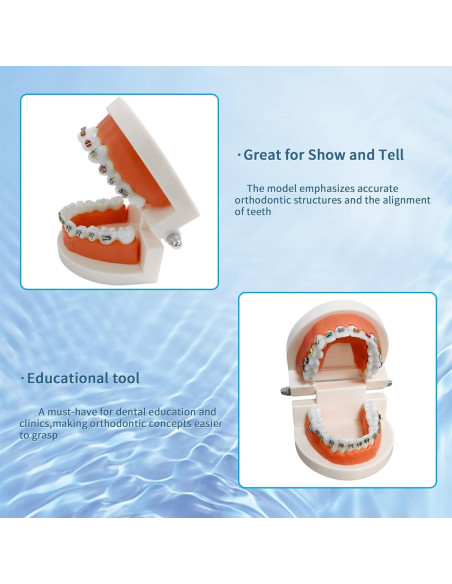 Modelo Dental Ortodontico Ceonam JY+YT con Brackets Coloridos
