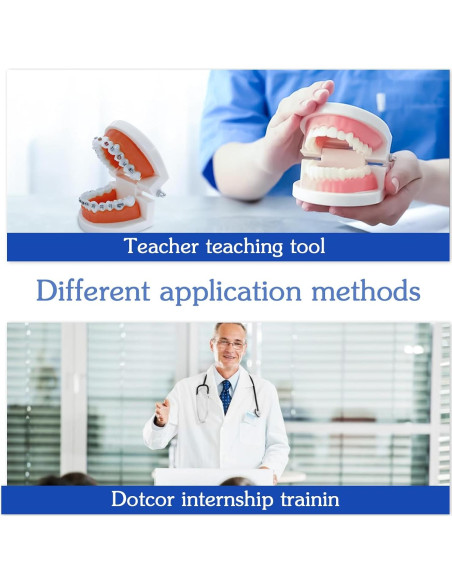 Modelo Dental Ortodontico Ceonam JY+YT con Brackets Coloridos