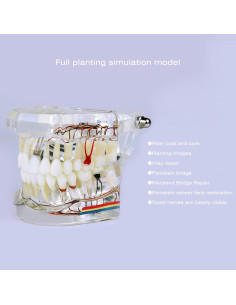 Modelo Dental Acrílico YOUYA para Enseñanza 9.4x6.6 cm 2