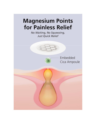 EasyDerm Parches Calmantes de Magnesio - 30 Parches Individuales