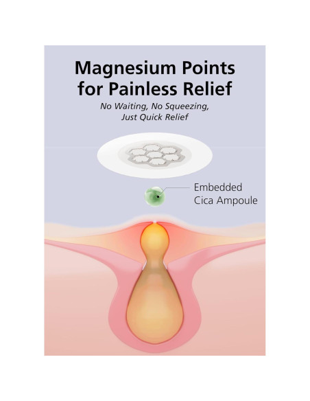 EasyDerm Parches Calmantes de Magnesio - 30 Parches Individuales