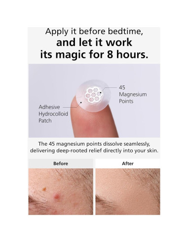 EasyDerm Parches Calmantes de Magnesio - 30 Parches Individuales
