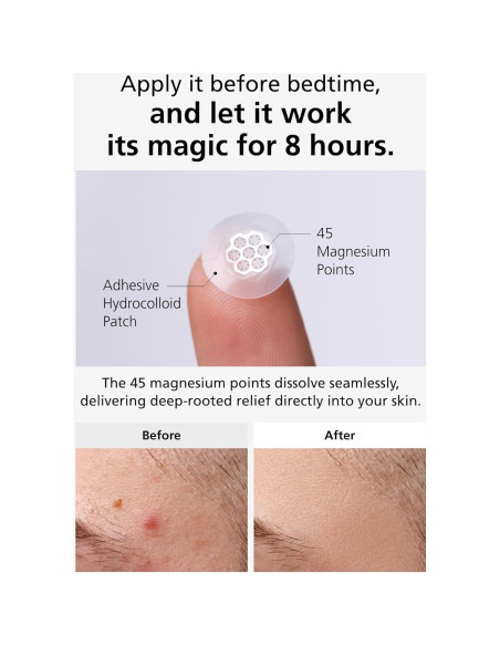 EasyDerm Parches Calmantes de Magnesio - 30 Parches Individuales