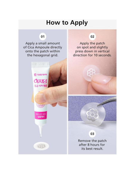 EasyDerm Parches Calmantes de Magnesio - 30 Parches Individuales