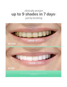 Gel Blanqueador Supersmile 198 g - Acelerador Profesional 2