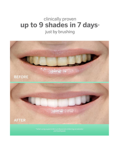 Gel Blanqueador Supersmile 198 g - Acelerador Profesional