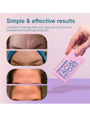Parches Faciales Frownies 144 unidades Hipoalergénicos