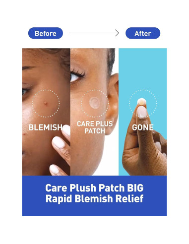 Parche para Acné OLIVE YOUNG Hidrocoloide 102 Unidades