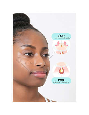 Parche para Acné OLIVE YOUNG Hidrocoloide 102 Unidades