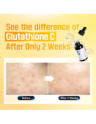 Suero Numbuzin No.5 | Vitamina C y Glutatión | 30 ml