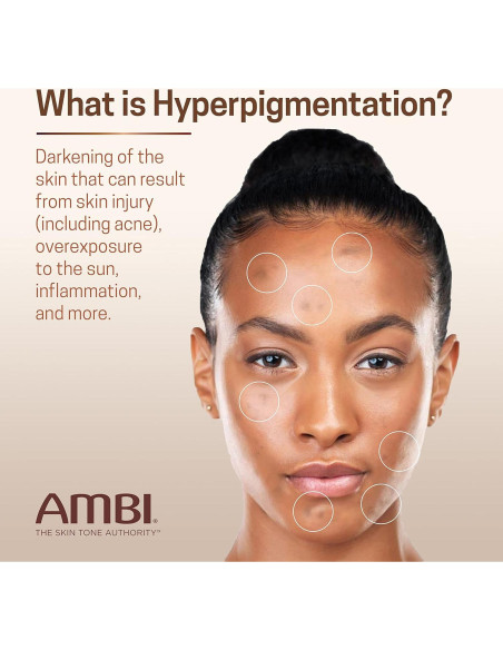 Crema Desvanecedora Ambi Even & Clear 29.57 ml - Hiperpigmentación