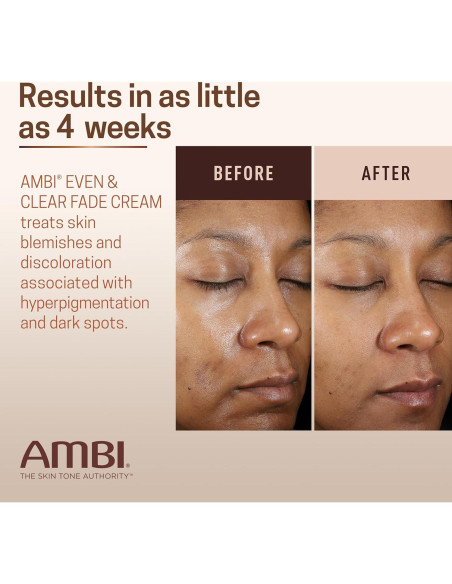 Crema Desvanecedora Ambi Even & Clear 29.57 ml - Hiperpigmentación