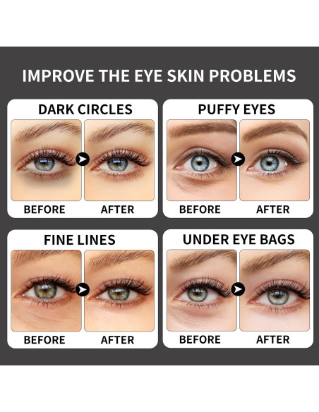 Parche de colágeno ROUSE con cafeína - 20 pares para ojeras Parche de colágeno ROUSE con cafeína - 20 pares para ojeras