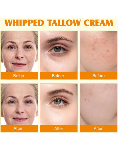 Bálsamo Hidratante Facial de Grasa de Res Meifenla 120g