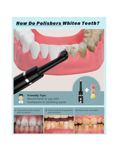 Pulidor Dental Zahnheld WD-JY-A02 con Luz LED y 5 Modos