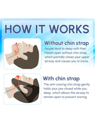 Correa para Barbilla Anti Ronquidos Mars Wellness Ajustable