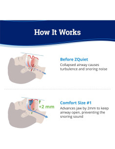 Dispositivo Antironquidos ZQuiet Confort 1 + Limpiador 1.5 oz 2