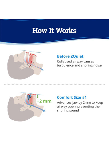 Dispositivo Antironquidos ZQuiet Confort 1 + Limpiador 1.5 oz