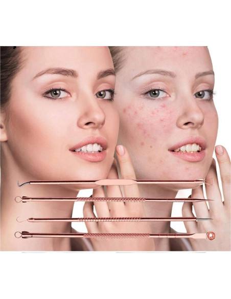 Kit Extractor de Puntos Negros Euxor - 4 Piezas Rosa