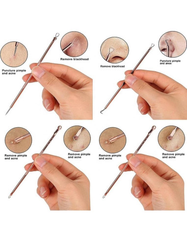 Kit Extractor de Puntos Negros Euxor - 4 Piezas Rosa