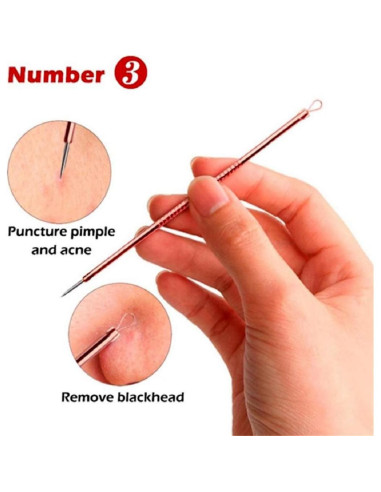 Kit Extractor de Puntos Negros Euxor - 4 Piezas Rosa