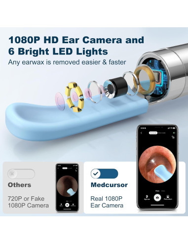 Medcursor Limpiador de Oídos con Cámara HD 1080P y LED