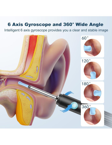 Medcursor Limpiador de Oídos con Cámara HD 1080P y LED