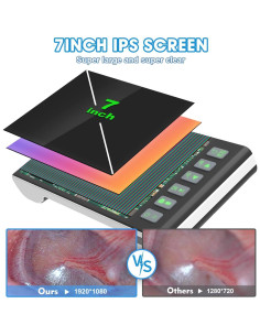 Otoscopio Digital Hiacinto 7" Pantalla IPS HD 3.9mm 2