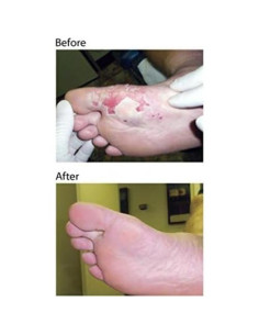 Miel de Herida Dr. Nordyke 80g Miel de Manuka Activa 2