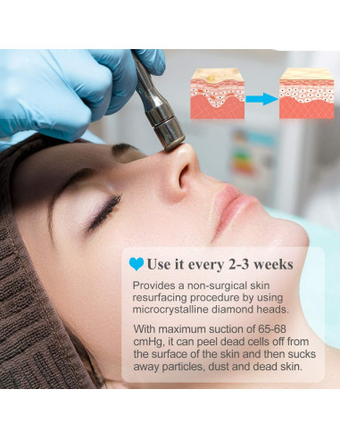 Máquina de Microdermoabrasión Diamante Mcwdoit 65-68 cmHg