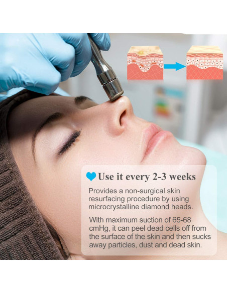 Máquina de Microdermoabrasión Diamante Mcwdoit 65-68 cmHg