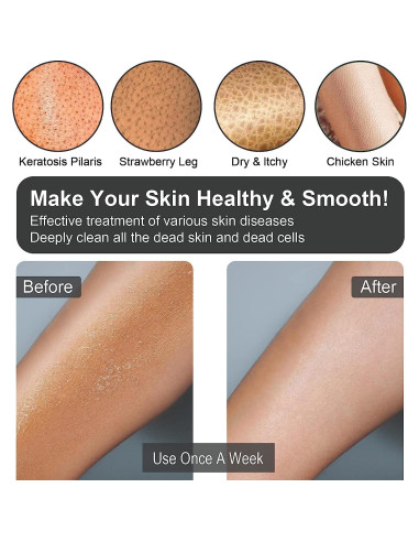 Guantes Exfoliantes Yiclick - Exfoliador Corporal 4 Piezas