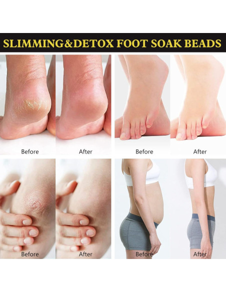 25 Perlas de Remojo para Pies Desintoxicantes BEFIVECOK 25 Perlas de Remojo para Pies Desintoxicantes BEFIVECOK