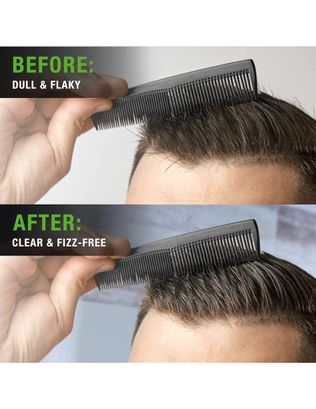 Juego de Champú y Acondicionador Viking Revolution - 482 ml