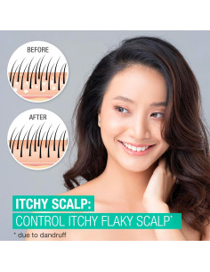 Champú Anticaspa Neutrogena 2.5% Ácido Salicílico 355ml 2