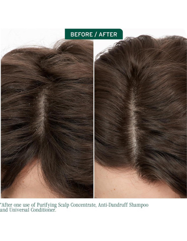 Champú Anticaspa Biolage Scalp Sync 363g - Controla Caspa