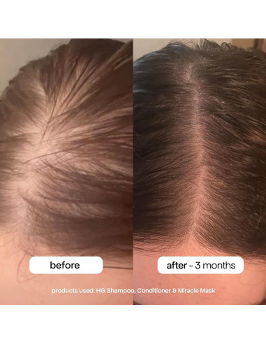 Mascarilla Hidratante BONDIBOOST 250g para Cabello Dañado