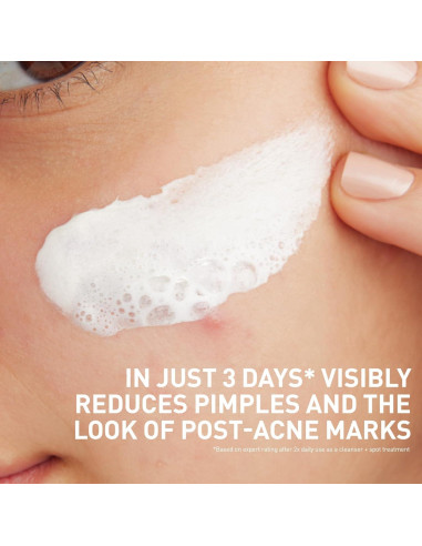 CeraVe Limpiador Facial Arcilla a Espuma 113 g Acné