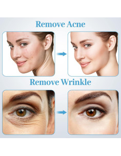 Máquina de Microdermoabrasión mcwdoit 2 en 1 Facial 3,18 kg 2