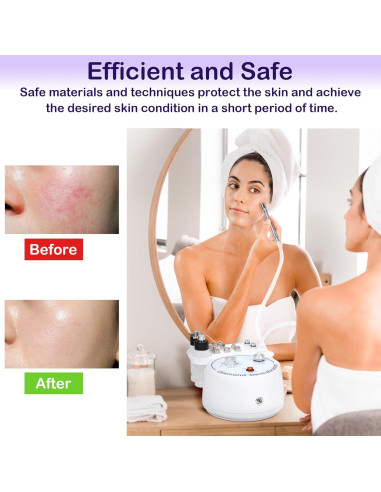 Máquina de Microdermoabrasión Kendal 3 en 1 Facial