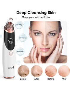 Extractor de Puntos Negros Daweir H001 - Aspirador Facial 2