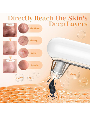 Extractor de Puntos Negros Yccu con 4 Modos y 5 Cabezas