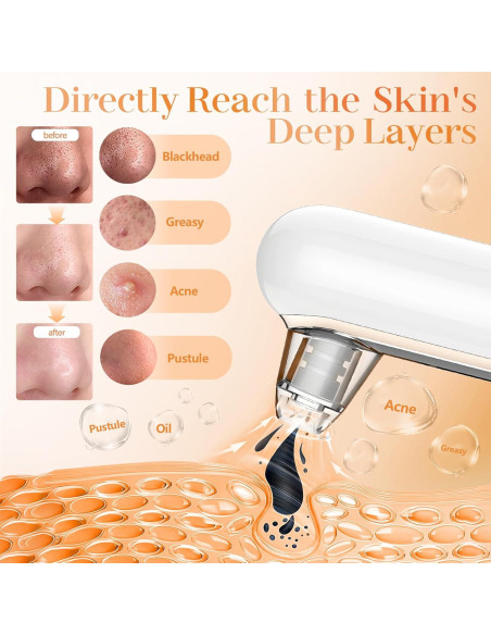 Extractor de Puntos Negros Yccu con 4 Modos y 5 Cabezas