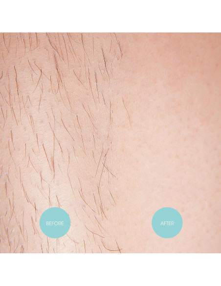 Cintas de Cera Extra Largas Nad's - Kit 20 Cintas + 4 Toallitas