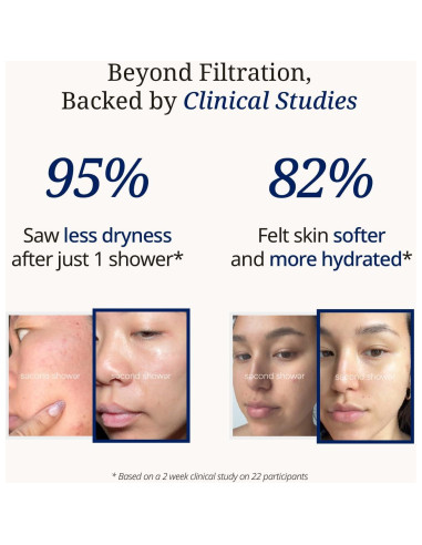 Cabezal de Ducha Filtrado SecondShower con Vitamina C 177,8 cm