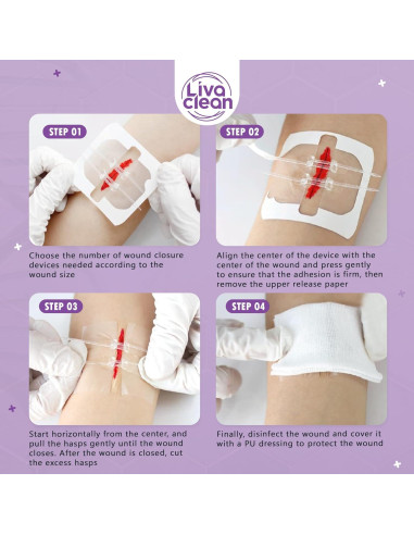 Cintas de Cierre de Heridas LivaClean 3 Unidades 5x5 cm