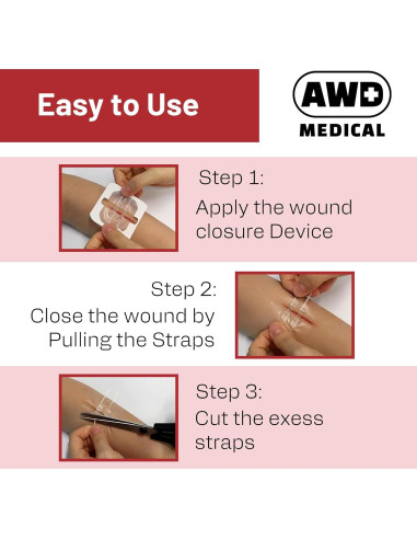 Cinta Quirúrgica de Cierre de Heridas AWD - Kit de 2