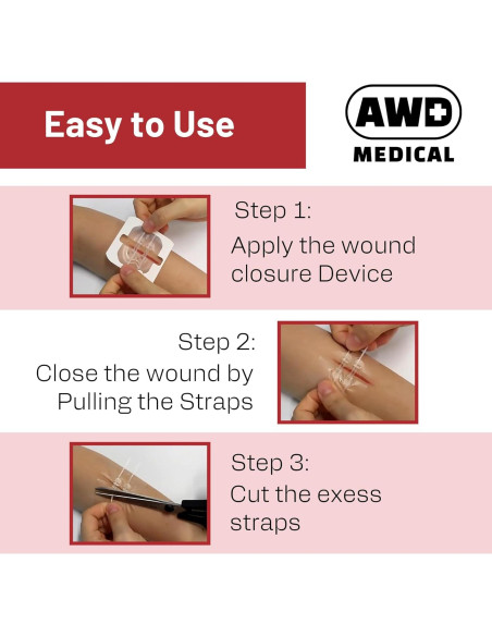 Cinta Quirúrgica de Cierre de Heridas AWD - Kit de 2