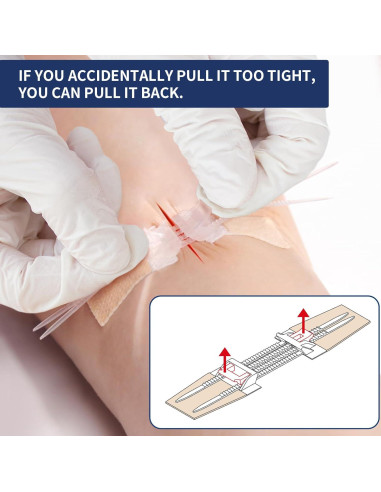 Cierre de Heridas de Emergencia URAY 4 Pcs Estériles